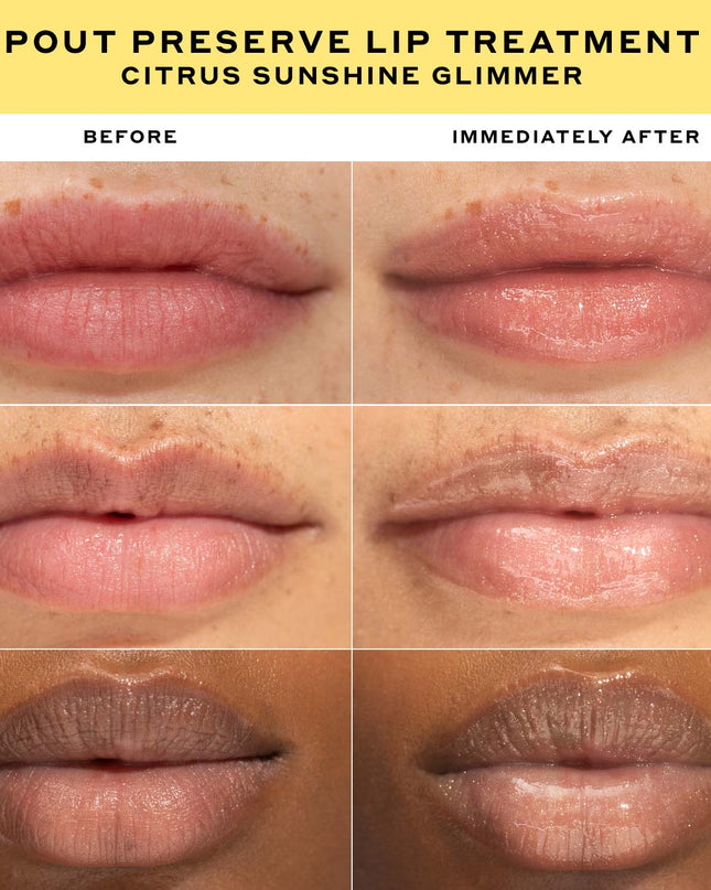 The viral lip treatment, now in a new glimmer finish. Sparkling lipcare, infused with lip-specific peptides and kokum butter, for clinically fuller-looking lips in just 1 week.*