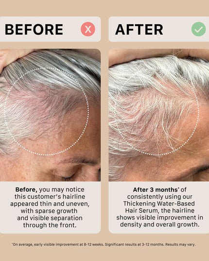 The ACTIIV Mens Trio Kit is a complete 90-day hair wellness system designed to support fuller, healthier-looking hair by balancing the scalp and optimizing follicle performance. Powered by plant-based, medical-grade technology, this 3-step system gently cleanses the scalp, reduces buildup, strengthens from root to tip, and supports thicker-looking density. Ideal for Men experiencing early signs of thinning and shedding.