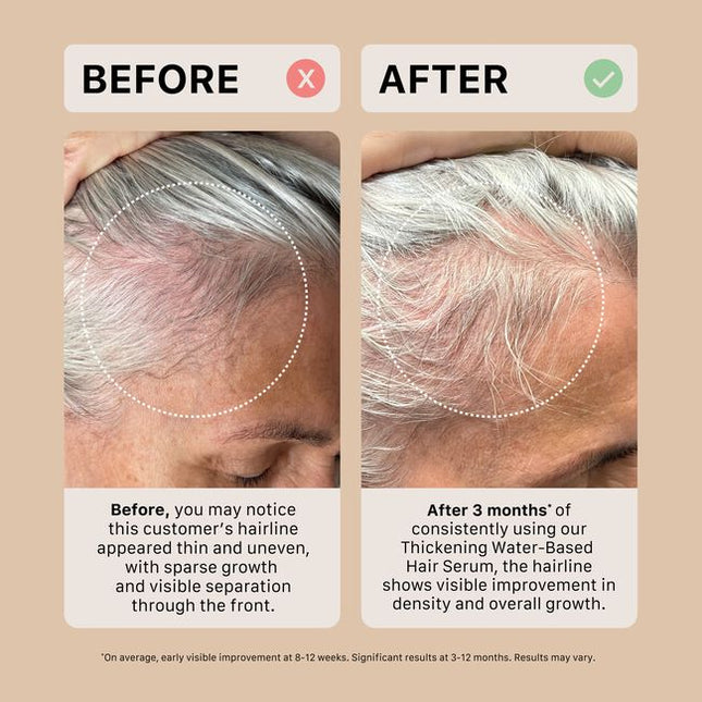 The ACTIIV Mens Trio Kit is a complete 90-day hair wellness system designed to support fuller, healthier-looking hair by balancing the scalp and optimizing follicle performance. Powered by plant-based, medical-grade technology, this 3-step system gently cleanses the scalp, reduces buildup, strengthens from root to tip, and supports thicker-looking density. Ideal for Men experiencing early signs of thinning and shedding.