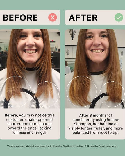 Renew is specially formulated to heal damaged and over-processed hair by helping to naturally close the hair cuticle using a powerful amino acid complex. With regular use, it encourages the appearance of thicker, fuller, and longer-looking hair.