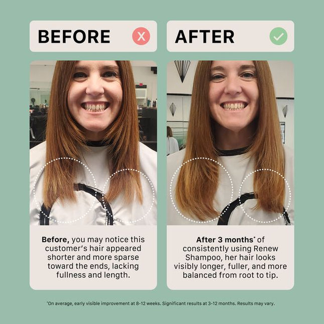 Renew is specially formulated to heal damaged and over-processed hair by helping to naturally close the hair cuticle using a powerful amino acid complex. With regular use, it encourages the appearance of thicker, fuller, and longer-looking hair.