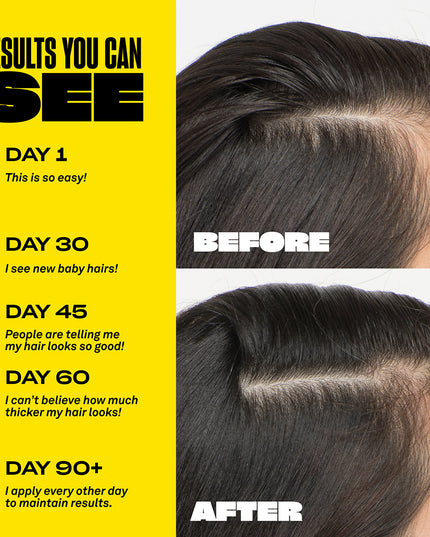 Denser, Longer, Healthier Looking Hair:

Healthier hair starts at the scalp. Give your hair some self-care with this powerful root serum to support a healthy scalp and encourage the appearance of denser and longer hair over time. Use the precise applicator to target specific areas or all over to replenish follicles and promote hair health.