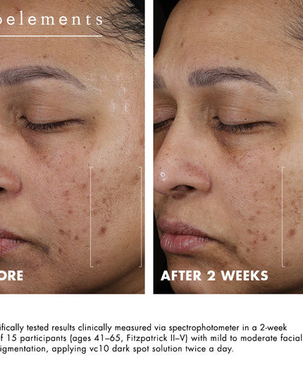 A precision hyperpigmentation treatment with 3% niacinamide + 10% vitamin C.