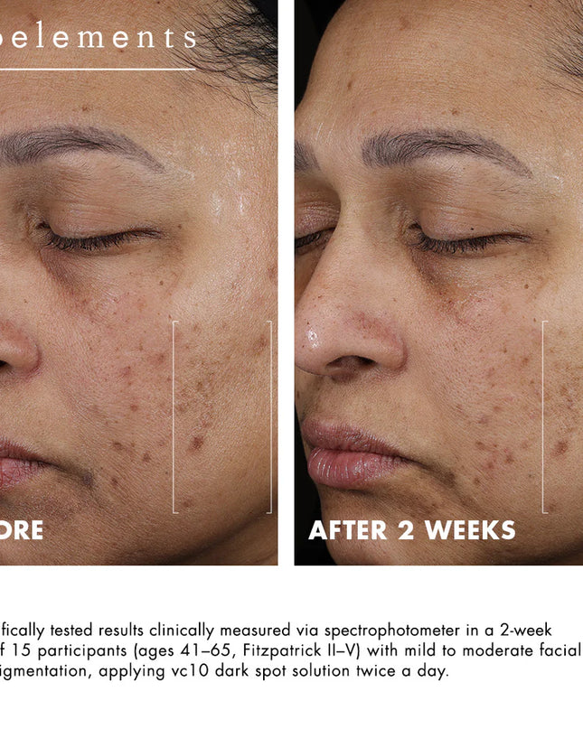 A precision hyperpigmentation treatment with 3% niacinamide + 10% vitamin C.