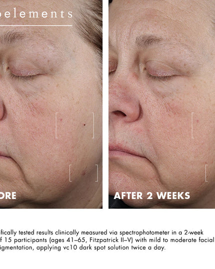 A precision hyperpigmentation treatment with 3% niacinamide + 10% vitamin C.