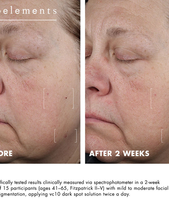 A precision hyperpigmentation treatment with 3% niacinamide + 10% vitamin C.