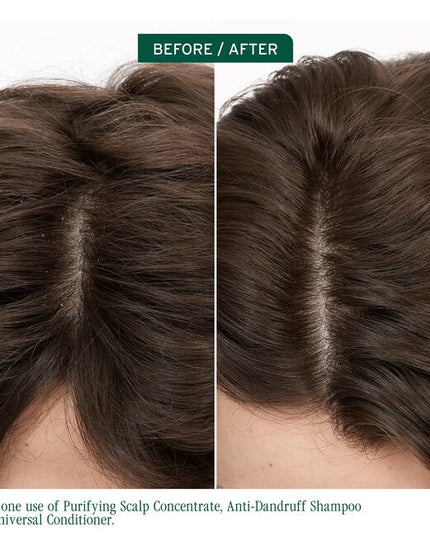 Scalp Sync Anti-Dandruff Shampoo is a specialized shampoo infused and micro-dosed with zinc pyrithione to help eliminate dandruff symptoms, including itching, irritation, redness, scaling, and flaking. It is designed to control the appearance of visible flakes and relieve irritation while nourishing the scalp and hair.