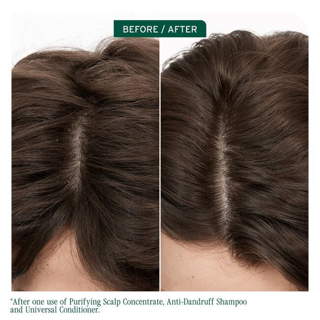 Scalp Sync Anti-Dandruff Shampoo is a specialized shampoo infused and micro-dosed with zinc pyrithione to help eliminate dandruff symptoms, including itching, irritation, redness, scaling, and flaking. It is designed to control the appearance of visible flakes and relieve irritation while nourishing the scalp and hair.