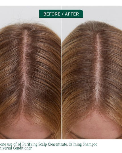 Scalp Sync Universal Conditioner is a versatile, lightweight conditioner designed to nourish all hair types while promoting a healthy scalp. Micro-dosed with a concentrate of a fermented tea blend and filtered glycolic acid, this rich, creamy formula gently conditions from root to tip without weighing down hair. It can also be applied directly to the scalp as a treatment to hydrate dry areas, offering relief for up to 72 hours*. 
