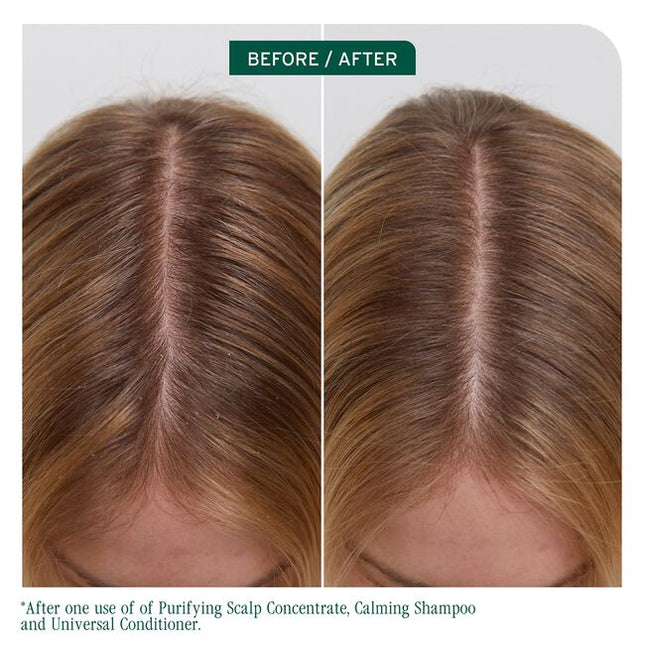 Scalp Sync Universal Conditioner is a versatile, lightweight conditioner designed to nourish all hair types while promoting a healthy scalp. Micro-dosed with a concentrate of a fermented tea blend and filtered glycolic acid, this rich, creamy formula gently conditions from root to tip without weighing down hair. It can also be applied directly to the scalp as a treatment to hydrate dry areas, offering relief for up to 72 hours*. 