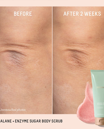 Shower yourself in double-exfoliation with our incredibly effective sugar body scrub with clinically proven, visible results for all skin types. Supercharged with both enzymatic and physical exfoliators, this gentle and potent formula delicately dissolves rough, dull skin without disrupting the ever-important moisture barrier.