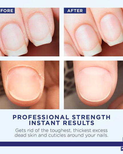 For 90+ years Blue Cross Professional Nail Care has been the preferred choice of manicurists, cosmetologists, nail artists, influencers, and beauticians for cuticle care and nail health - leaving nail beds clean, bright, moisturized, and nourished.