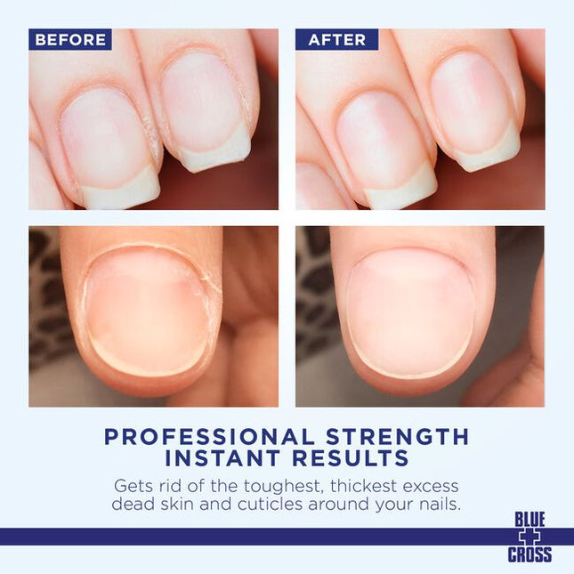 For 90+ years Blue Cross Professional Nail Care has been the preferred choice of manicurists, cosmetologists, nail artists, influencers, and beauticians for cuticle care and nail health - leaving nail beds clean, bright, moisturized, and nourished.