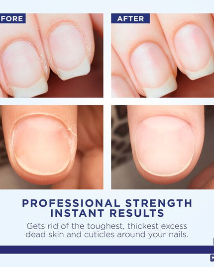 For 90+ years Blue Cross Professional Nail Care has been the preferred choice of manicurists, cosmetologists, nail artists, influencers, and beauticians for cuticle care and nail health - leaving nail beds clean, bright, moisturized, and nourished.