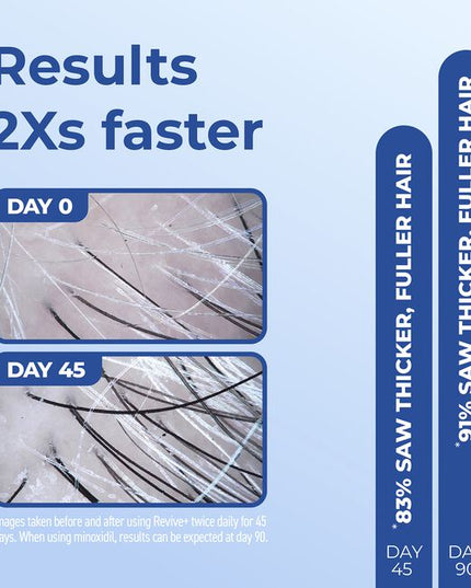 Give Thinning Hair The Finger! Get thicker, fuller-looking hair in as little as 45 days with this breakthrough hair growth technology co-created by Bosley Doctors and Yuva Biosciences. It is the first ever thinning hair solution formulated using artificial intelligence. AI processed thousands of compounds to identify the exact molecule need to support healthy mitochondria.†