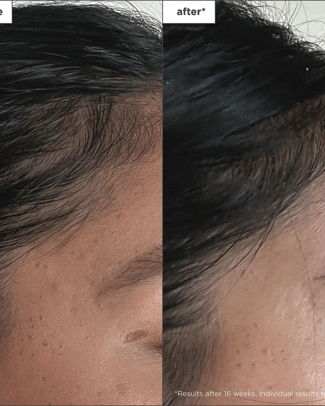 Lightweight, fast-absorbing serum that helps promote hair’s density and encourages nutrient-rich microcirculation to the scalp.