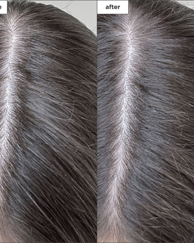 A charcoal-infused aerosol-free dry shampoo that refreshes hair and supports a healthy scalp. Detoxifies, refreshes, and balances the scalp + hair to extend the time between washes.