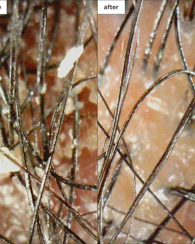 An exfoliating, sulfate-free scalp scrub that is clinically shown to increase scalp hydration up to 120%.* Soothes dry, itchy, irritated scalps.