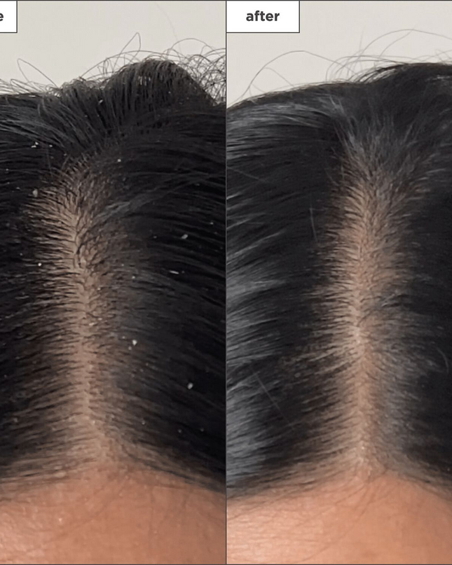 A scalp exfoliating pre-wash treatment that gently eliminates product buildup and dry shampoo scalp congestion for a more effective cleanse.
