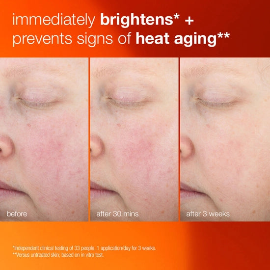 Daily moisturizer with SPF 50 helps defend against signs of skin aging from UVA/UVB rays.