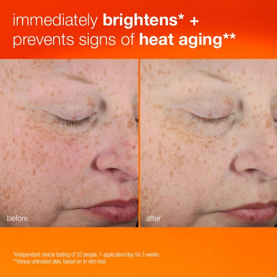 Daily moisturizer with SPF 50 helps defend against signs of skin aging from UVA/UVB rays.