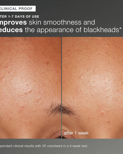 Achieve brighter, smoother skin every day with this iconic exfoliating powder. Rice-based powder activates upon contact with water, releasing Papain, Salicylic Acid and Rice Enzymes to polish skin to perfection. A Skin Brightening Complex of Rice Bran (including Phytic Acid), White Tea, and Licorice helps balance uneven skin tone while a soothing blend of Colloidal Oatmeal and Allantoin helps calm skin. Gentle enough for daily use.