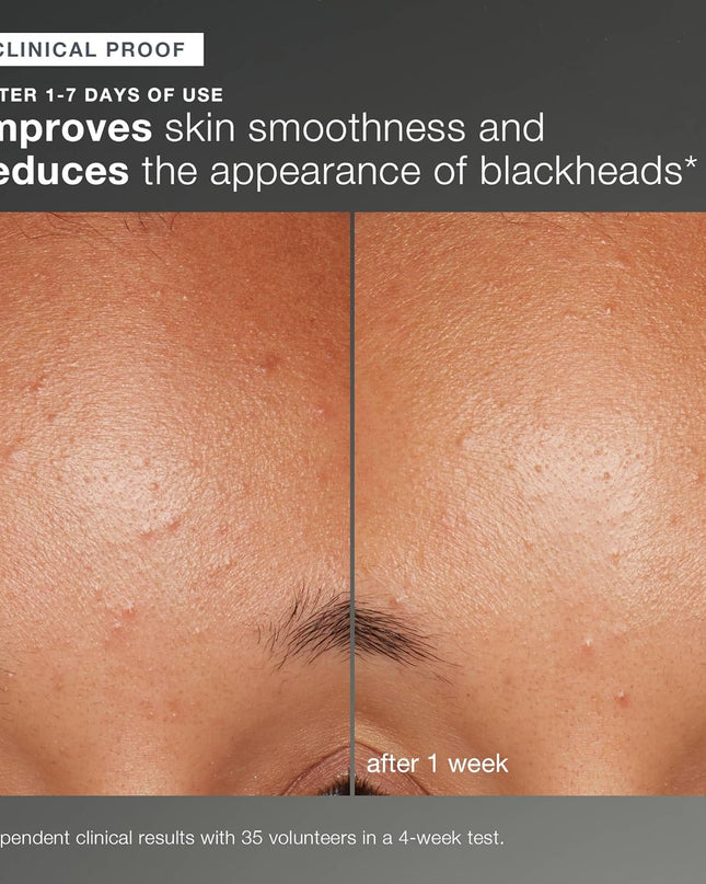 Achieve brighter, smoother skin every day with this iconic exfoliating powder. Rice-based powder activates upon contact with water, releasing Papain, Salicylic Acid and Rice Enzymes to polish skin to perfection. A Skin Brightening Complex of Rice Bran (including Phytic Acid), White Tea, and Licorice helps balance uneven skin tone while a soothing blend of Colloidal Oatmeal and Allantoin helps calm skin. Gentle enough for daily use.