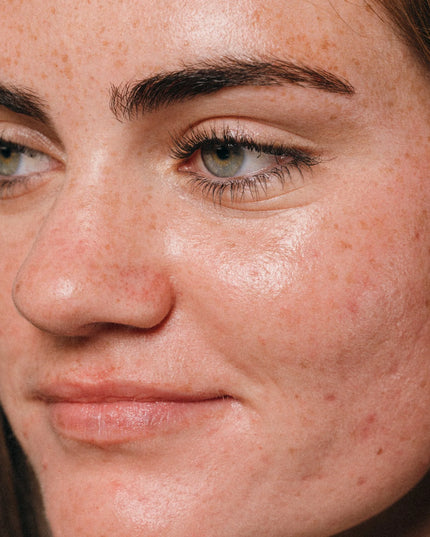 Finally, a mist that can do it all: minimize visible pores, reduce excess oil, and help diminish the appearance of post-breakout marks. Formulated with niacinamide and an antioxidant-rich blend, from the first spritz, get smaller pores by the time you walk out the door. 