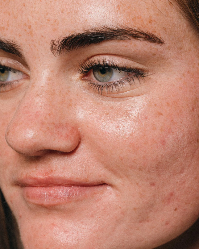 Finally, a mist that can do it all: minimize visible pores, reduce excess oil, and help diminish the appearance of post-breakout marks. Formulated with niacinamide and an antioxidant-rich blend, from the first spritz, get smaller pores by the time you walk out the door. 