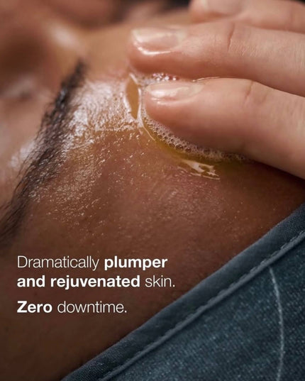 An energizing experience with downtime-free results.