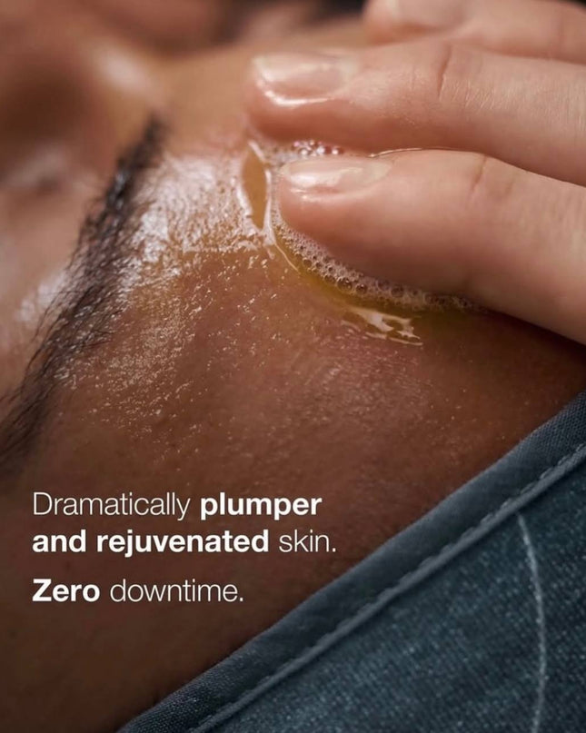 An energizing experience with downtime-free results.