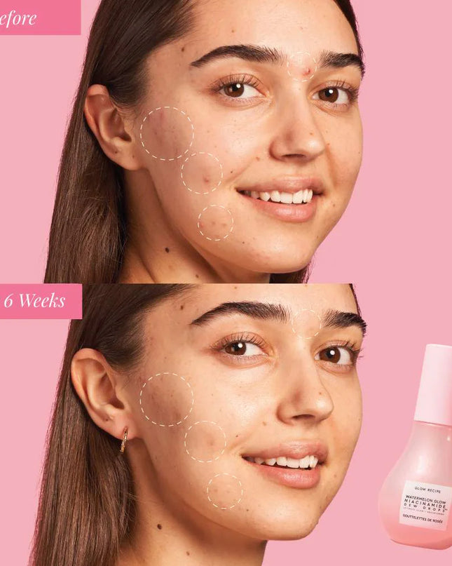 A travel-ready duo featuring a bestselling, visibly brightening serum and a full-size translucent SPF 45 hydrating stick for easy, mess-free application anywhere.