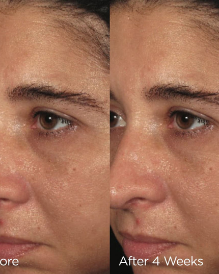 This nourishing repair crème is clinically proven to improve skin hydration, clarity, and luminosity. With organic grape water, botanical butters, and organic plant extracts, it works to boost and balance moisture-depleted skin, leaving it soft and glowing. A tetrapeptide complex helps to promote the appearance of luminous, lit-from-within skin. The plush, velvety texture melts into the skin for an instant skin-soothing experience.