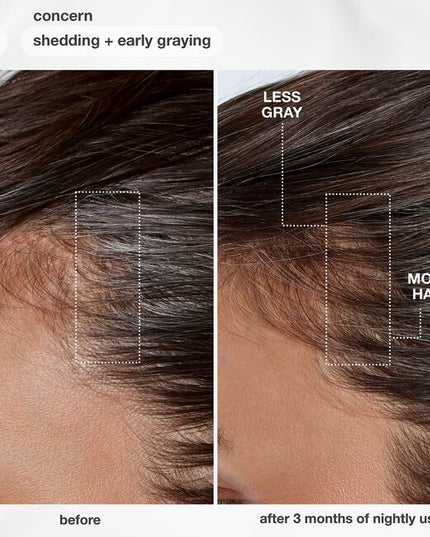 Lightweight serum clinically proven to deliver up to 19,000 more hairs, fewer grays, and improved scalp barrier. Powered by proprietary MultiVital™ technology, the first synergistic multi-pathway system for premature hair aging.
