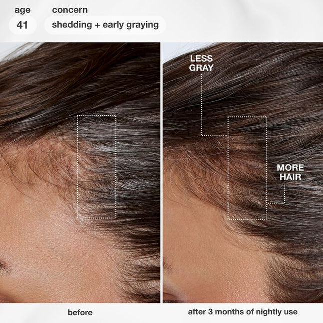 Lightweight serum clinically proven to deliver up to 19,000 more hairs, fewer grays, and improved scalp barrier. Powered by proprietary MultiVital™ technology, the first synergistic multi-pathway system for premature hair aging.