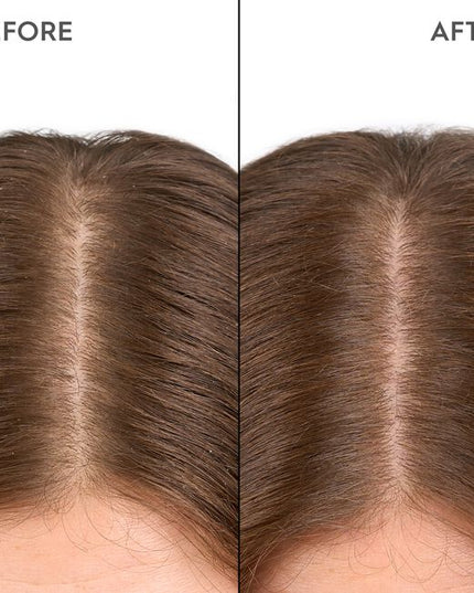 A highly effective serum with Biomimetic Silk, 1% Ectoin &amp; 1% Niacinamide. Kerasilk's 100% vegan* formula deeply moisturizes the scalp, relieving itchiness, redness, irritation, and flaking, while fortifying against external stressors.
*no animal-derived ingredients"