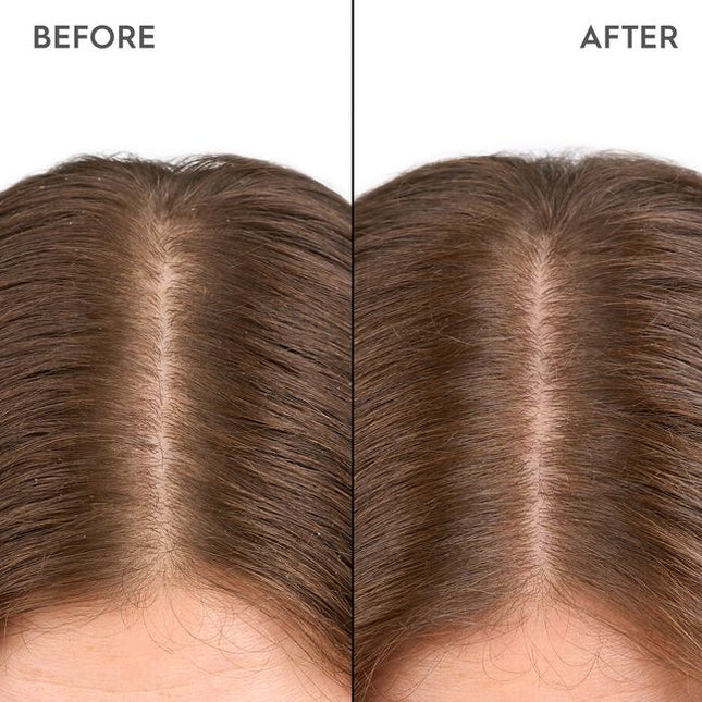 A highly effective serum with Biomimetic Silk, 1% Ectoin &amp; 1% Niacinamide. Kerasilk's 100% vegan* formula deeply moisturizes the scalp, relieving itchiness, redness, irritation, and flaking, while fortifying against external stressors.
*no animal-derived ingredients"