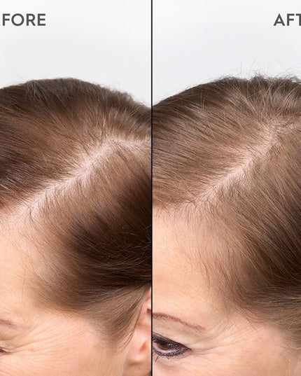 A highly effective serum infused with Biomimetic Silk, Ectoin &amp; T-Flavanone. Kerasilk's 100 % vegan* formula protects from hereditary hair loss, strengthens the roots and redensifies for long-lasting thicker and denser hair.
*no animal-derived ingredients