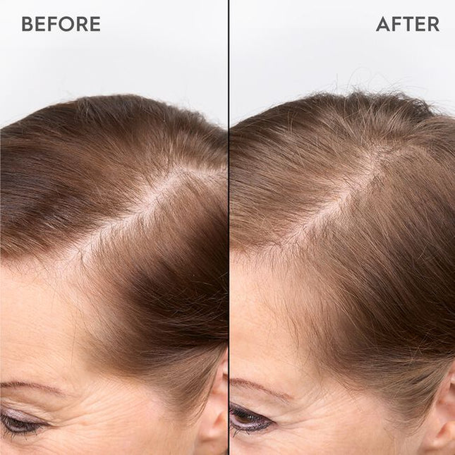 A highly effective serum infused with Biomimetic Silk, Ectoin &amp; T-Flavanone. Kerasilk's 100 % vegan* formula protects from hereditary hair loss, strengthens the roots and redensifies for long-lasting thicker and denser hair.
*no animal-derived ingredients