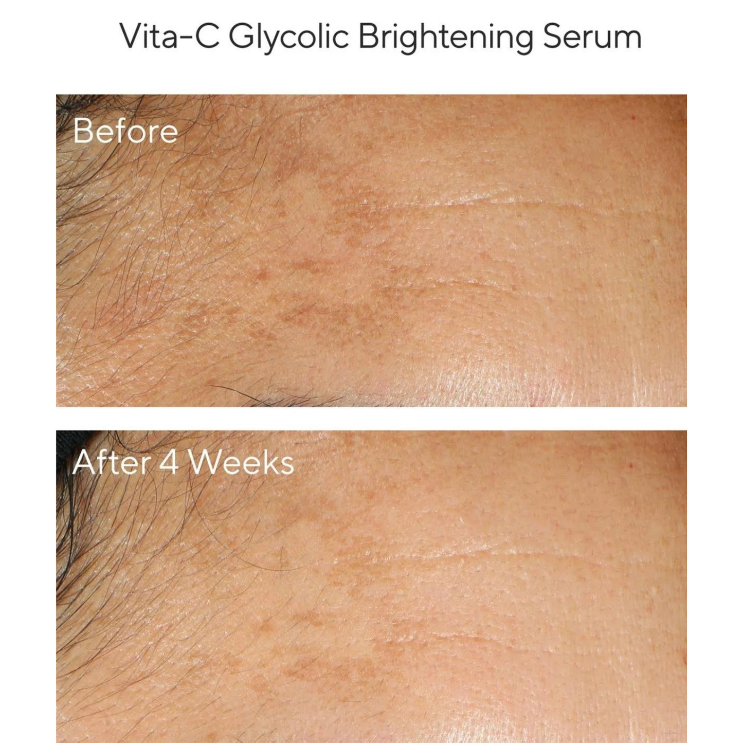 Murad - Brighten Trial Kit