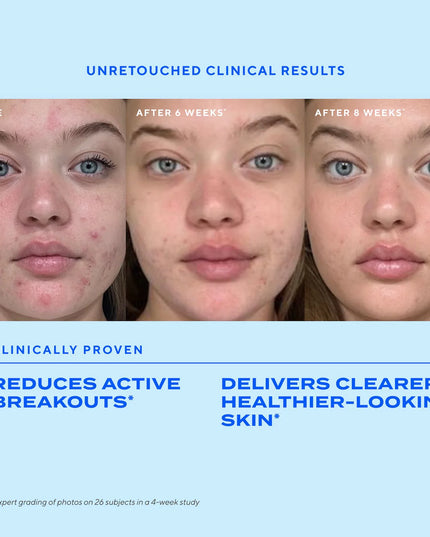 Kit includes travel-size Clarifying Cleanser, Murad's non-stripping, non-drying, foaming gel cleanser that's clinically proven to dissolve excess oil, full-size Rapid Relief Acne Spot Treatment to reduce blemish size and redness in 4 hours, and travel-size Biome-Balancing Clear & Prevent Acne Treatment Serum, an all-over daily treatment serum that clears breakouts and balances the skin’s microbiome to naturally resist future breakouts for clearer, healthier-looking skin