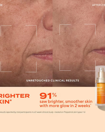 3-piece discovery kit includes travel-sizes of vitamin-rich Essential-C Cleanser that washes away impurities and urban pollution, Vita-C Glycolic Serum with super-stable vitamin C for dramatically brighter, healthier-looking skin, and Superactive Moisturizer SPF 50: Brightening (formerly Essential-C Day Moisture SPF 50), an ultra-sheer, moisturizing SPF with 10x more vitamin C† to visibly brighten after 1 use.