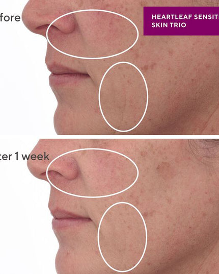 Gentle, non-stripping, non-foaming face cleanser with ceramides and skin-boosting lipids to fortify the skin barrier against external inflammatory triggers