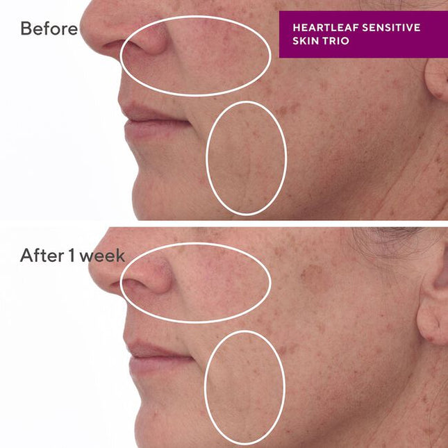 Gentle, non-stripping, non-foaming face cleanser with ceramides and skin-boosting lipids to fortify the skin barrier against external inflammatory triggers