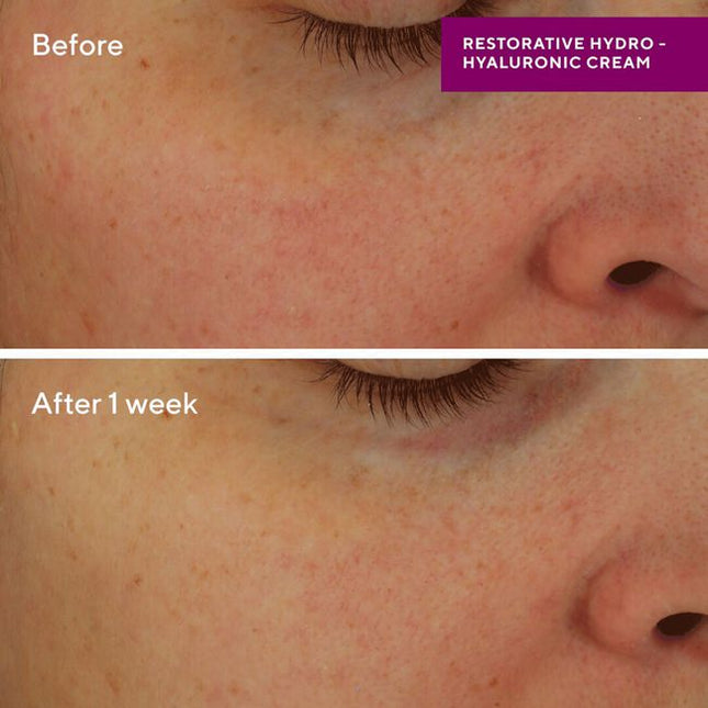 Formerly Hydro-Dynamic Moisture, new name, same formula you love! Murad's most luxurious cream, including Advanced Hydro-Hyaluronic Technology, delivers 24 hours of intense hydration with continued use*