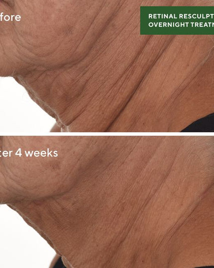 Our next-gen serum features retinal—one of the most efficacious forms of vitamin A—encapsulated in a delivery system that’s adapted from technology used in pharmaceutical applications. 