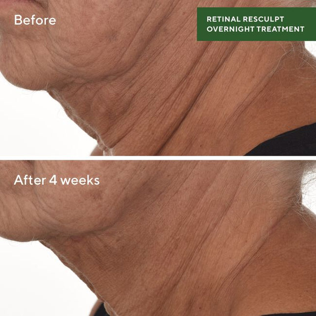 Our next-gen serum features retinal—one of the most efficacious forms of vitamin A—encapsulated in a delivery system that’s adapted from technology used in pharmaceutical applications. 