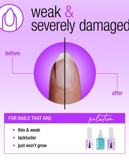 The Nail Rescue System is the ultimate rehab for severely damaged nails. This carefully curated system of unique formulations work together to improve nail strength, promoting the appearance of healthier nails and assisting in more resilient nail growth long-term.