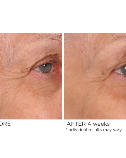 A deeply penetrating eye serum that diminishes puffiness, reduces crow’s feet and improves the appearance of dark circles with a professional blend of hexapeptides, tetrapeptides and high molecular weight hyaluronic acid. Moisturizing and hydrating, this age-defying treatment uses pullulan to prevent water loss and aloe vera to soothe and smooth skin to help eyes appear brighter, and younger, and visibly soften lines and wrinkles.