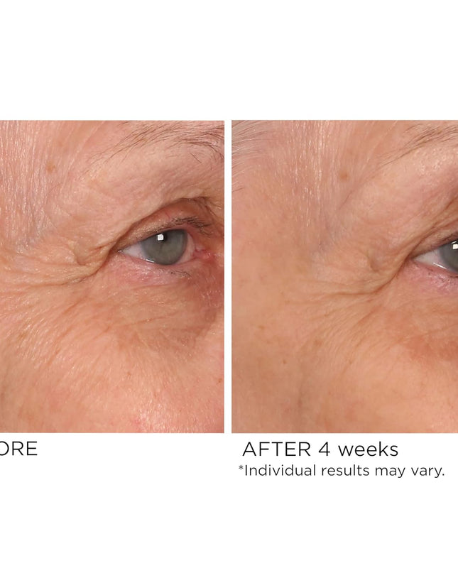 A deeply penetrating eye serum that diminishes puffiness, reduces crow’s feet and improves the appearance of dark circles with a professional blend of hexapeptides, tetrapeptides and high molecular weight hyaluronic acid. Moisturizing and hydrating, this age-defying treatment uses pullulan to prevent water loss and aloe vera to soothe and smooth skin to help eyes appear brighter, and younger, and visibly soften lines and wrinkles.